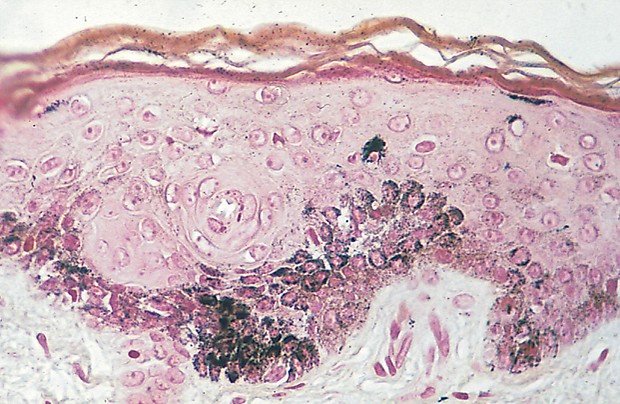 Masson Fontana -osoitusvärjäyskitti