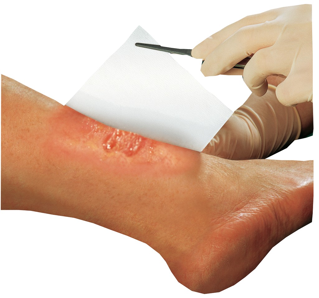 Solvaline N haavatyyny 20 x 30 cm steriili