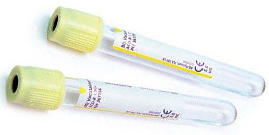 BD Vacutainer ACD-lasiputki liuos A