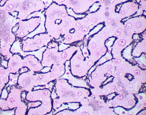 Gordon Sweet -osoitusvärjäyskitti