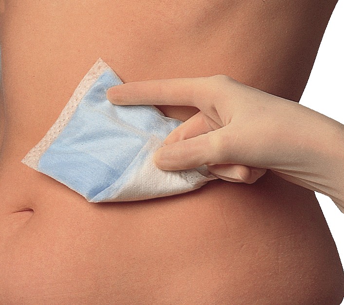 Klinion Exsupad haavatyyny 9 x 12 cm steriili 50 x 1