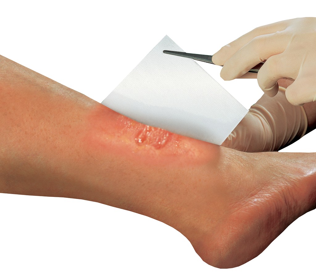 Solvaline N -haavatyyny 20 x 30 cm ston