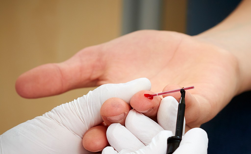 Boule Micro Pipettes