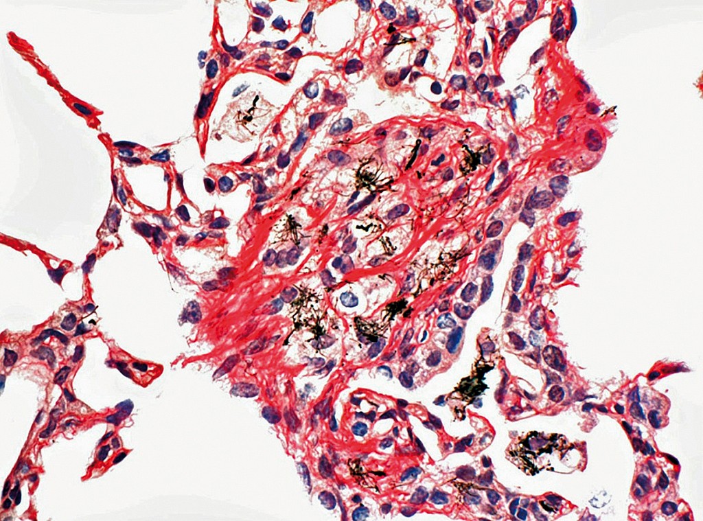 Sirius Red -osoitusvärjäyskitti