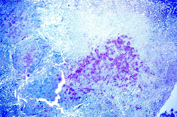 Ziehl-Neelsen Fite -osoitusvärjäyskitti