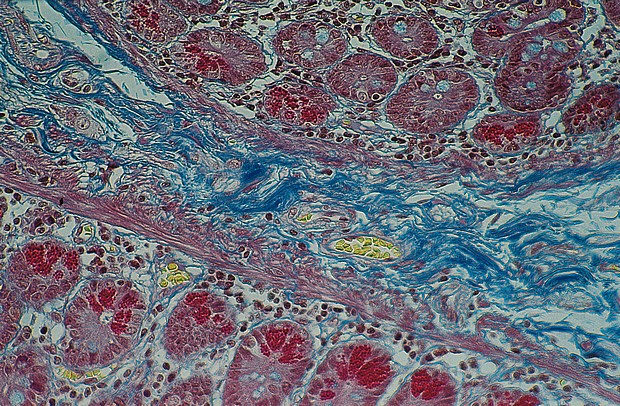 Masson trikromi -osoitusvärjäyskitti