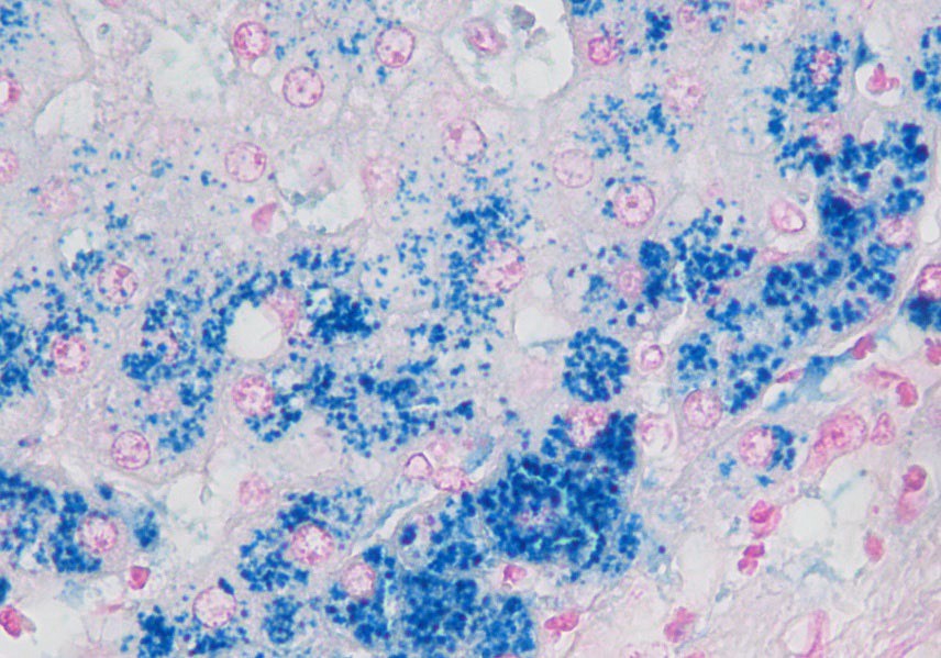Perls raudan -osoitusvärjäyskitti