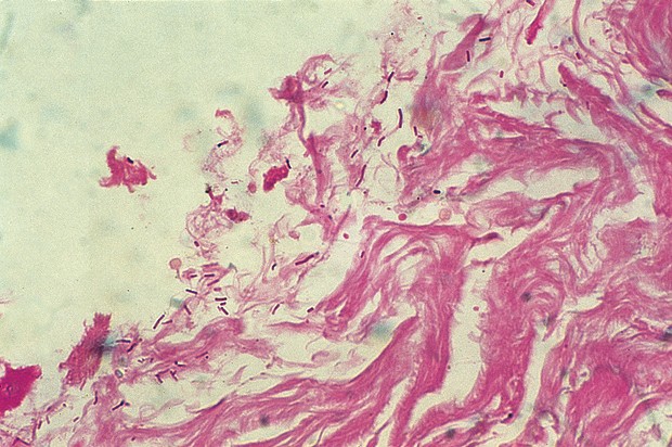 Gram -osoitusvärjäyskitti
