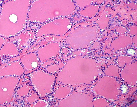 HE -osoitusvärjäyskitti