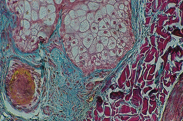 Masson-Golder trikromi -osoitusvärjäyskitti