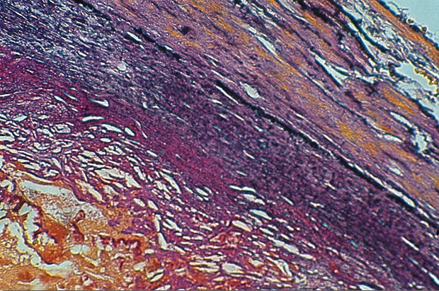 Weigert Van Gieson -osoitusvärjäyskitti