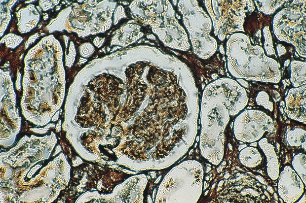 PASM -osoitusvärjäyskitti