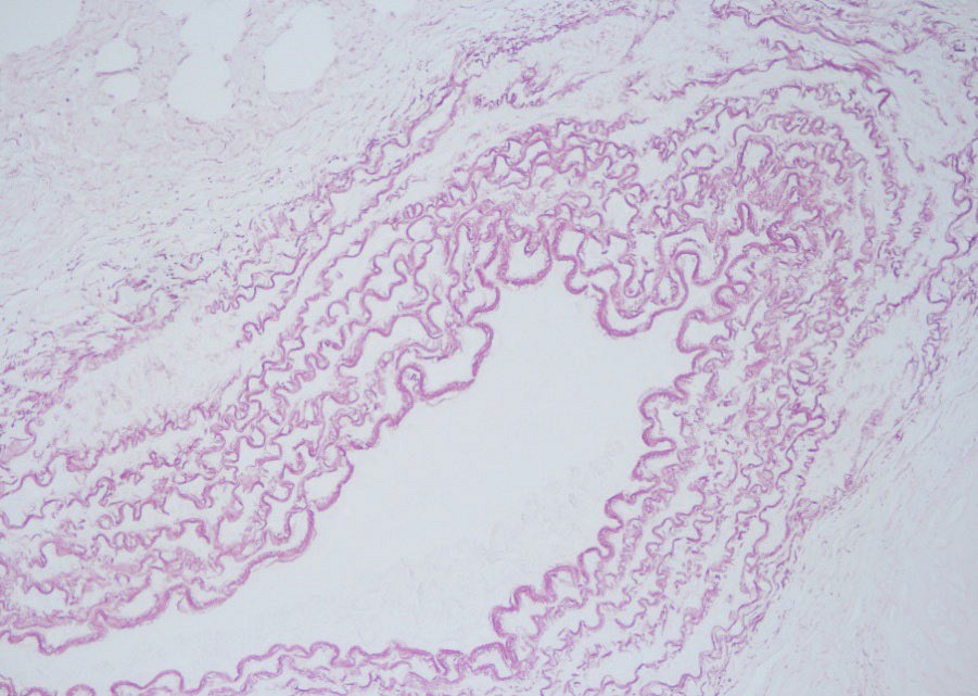 Orcein -osoitusvärjäyskitti