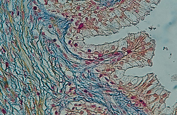 Mallory trikromi -osoitusvärjäyskitti