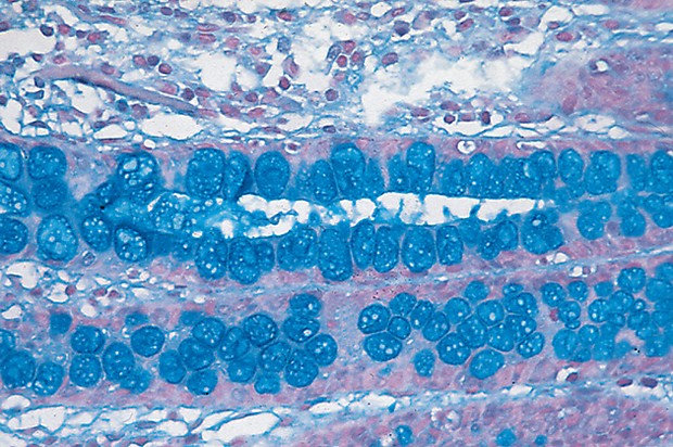 Alcian Blue -osoitusvärjäyskitti