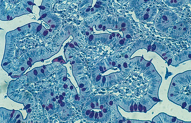 Alcian Blue-PAS -osoitusvärjäyskitti