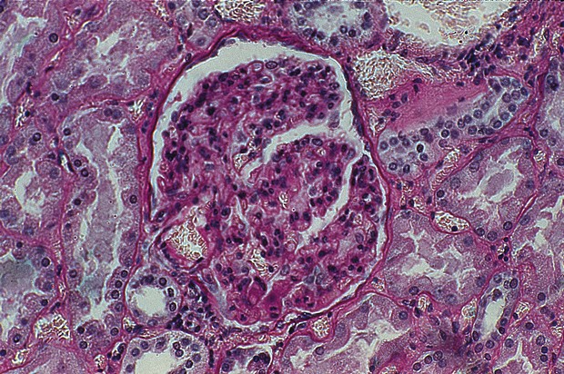 PAS -osoitusvärjäyskitti