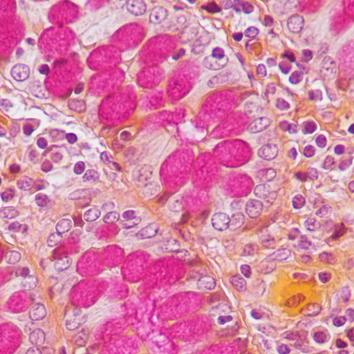 Mucicarmine -osoitusvärjäyskitti