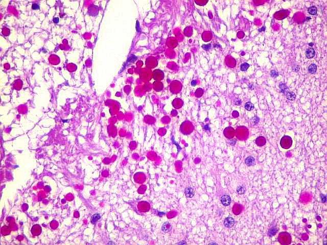 Diastaasi -entsyymikitti