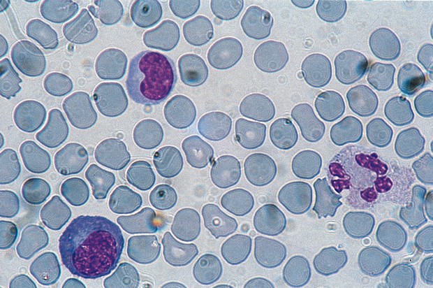 May-Grünwald Giemsa -värjäyskitti 3 x 1000 ml