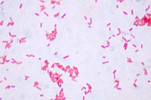 Gram -värjäyskitti 5 x 500 ml