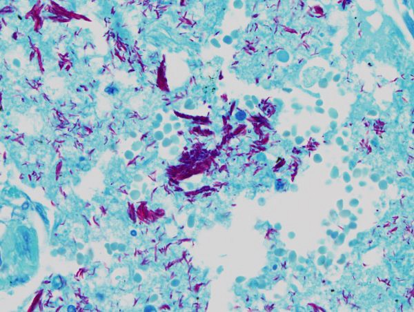 Ziehl-Neelsen Fite -värjäyskitti 4 x 500 ml