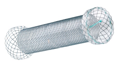 Taewoong Niti-S kolonstentti 26 x 8 cm