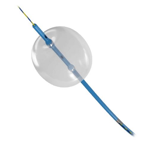 MTE Stone extraction balloon, Disp 9-12-15