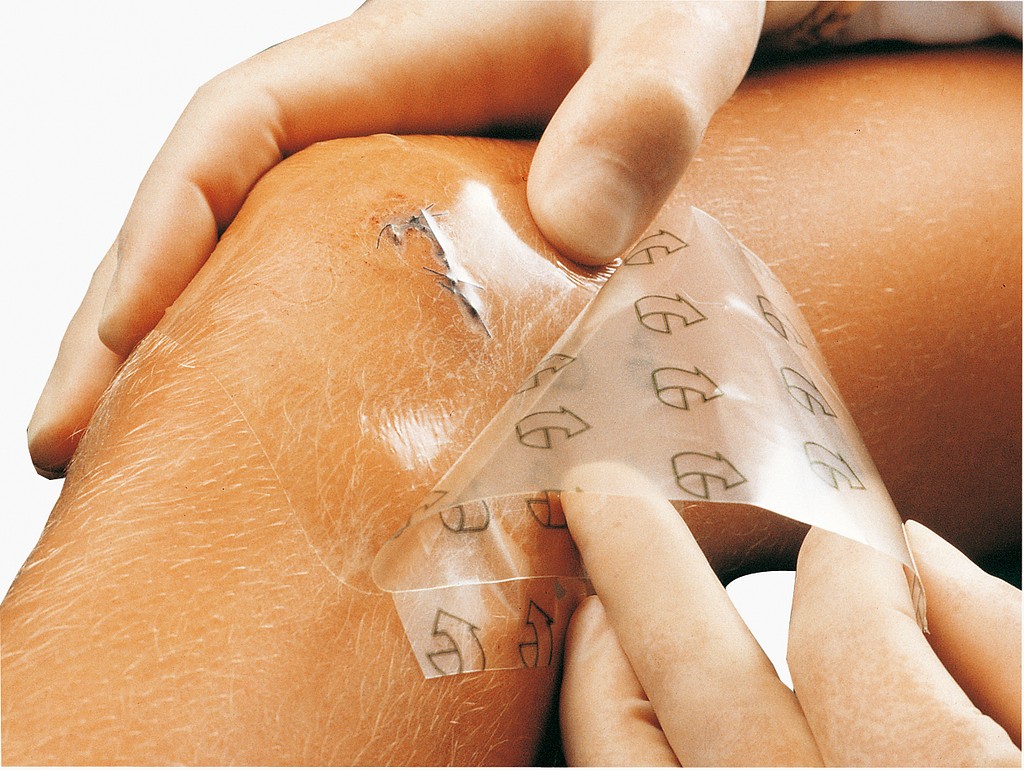 Suprasorb F -kiinnittyvä haavakalvo 20 x 30 cm steriili