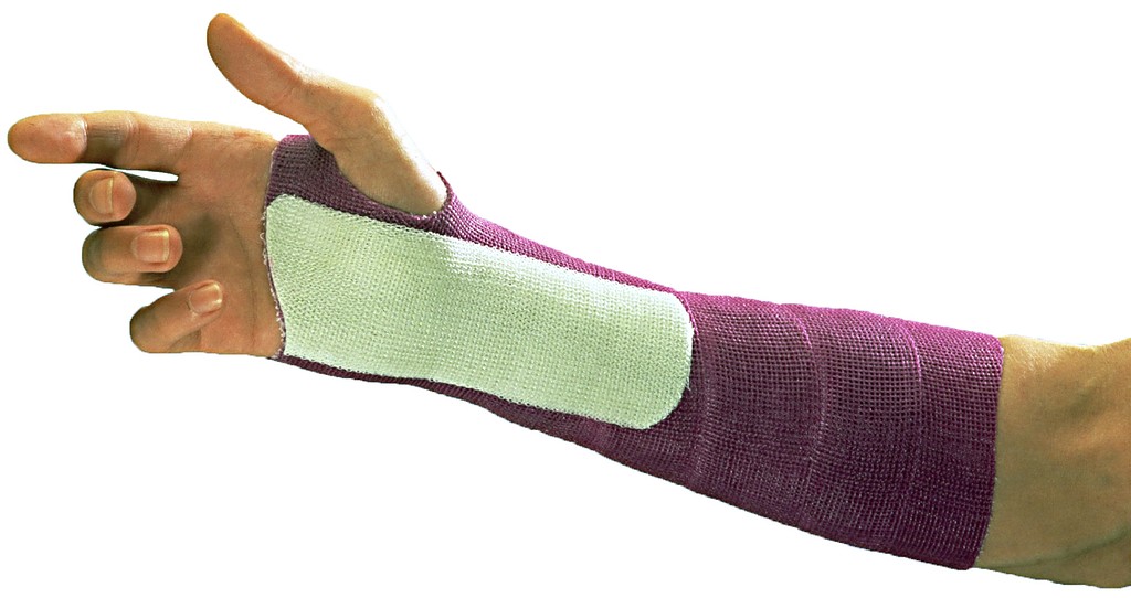 Soft Cast pehmytkipsi valkoinen 12,7 cm x 3,66 m