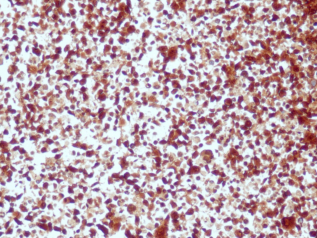 ALK (QR017) Rb 0,5 ml konsentraatti