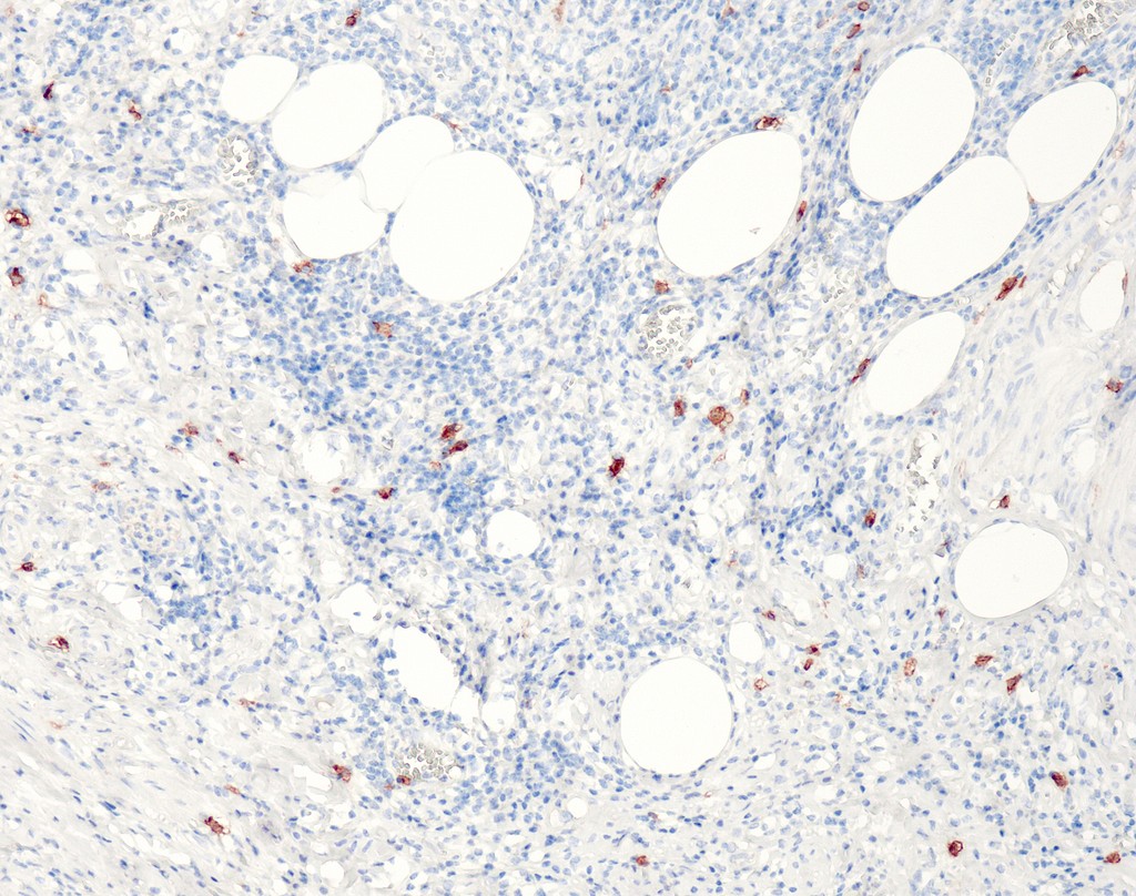 CD117 (QR012) Rb 0,5 ml konsentraatti