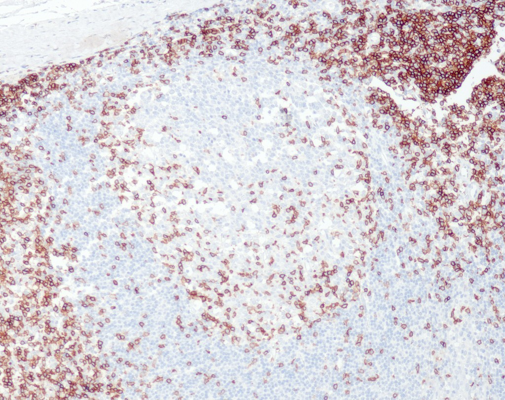 CD3e (QR004) Rb 0,5 ml konsentraatti