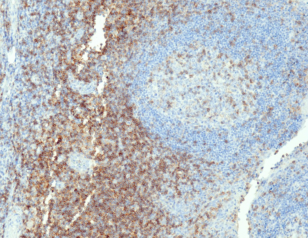 CD4 (QR032) Rb 0,5 ml konsentraatti