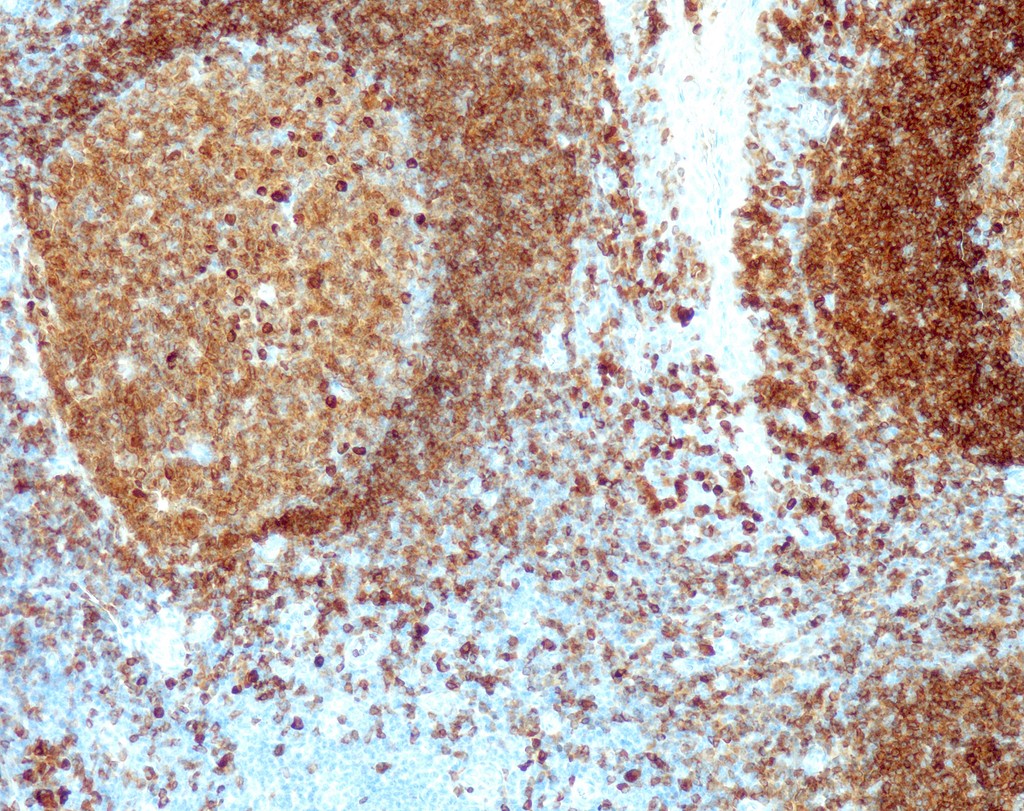 CD79a (QR033) Rb 0,5 ml konsentraatti