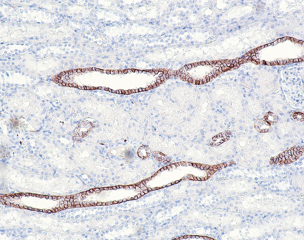 CD171 / L1CAM (QR039) Rb 0,5 ml konsentraatti