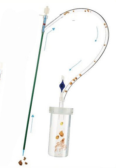 Ureteral Access Sheath, 10-12 Fr x 36cm