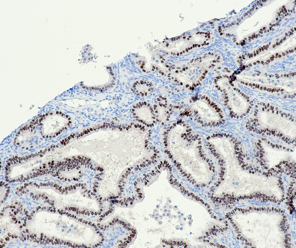 PAX8 (QR016) Rb 0,1ml konsentraatti
