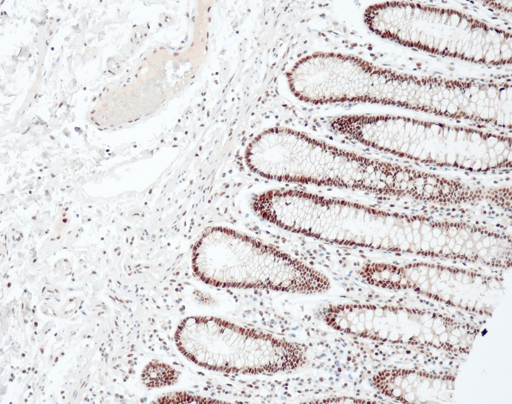 MLH1 (QM003) Ms 1,0 ml konsentraatti
