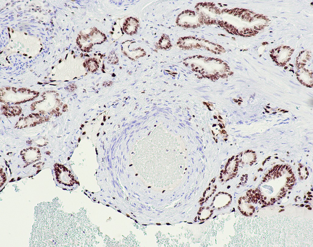 ERG (QR040) Rb 0,5 ml konsentraatti