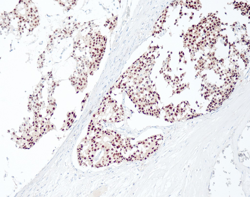 Estrogen Receptor (QR013) Rb 0,5 ml konsentraatti