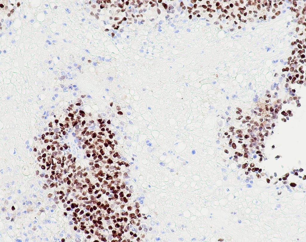 GATA3 (QR018) Rb 0,5 ml konsentraatti