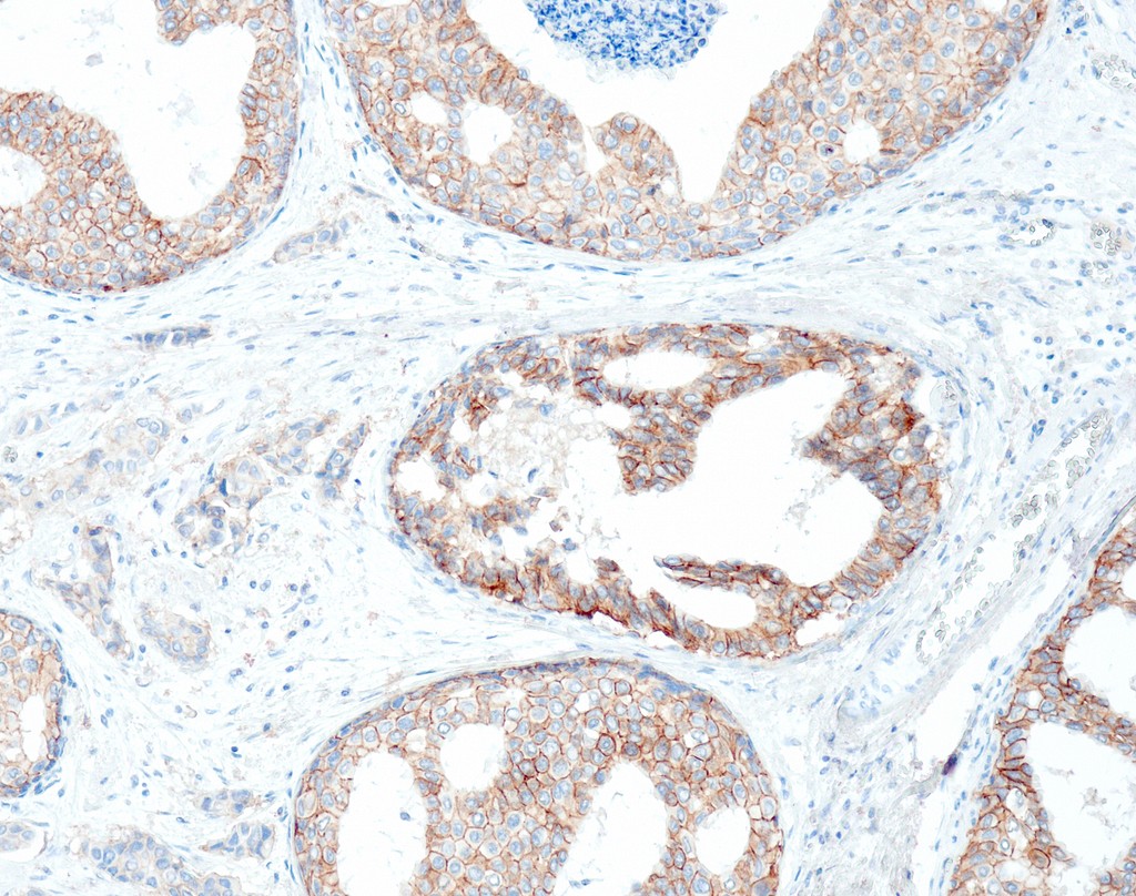 Her2/Neu (QR003) Rb 0,5 ml konsentraatti