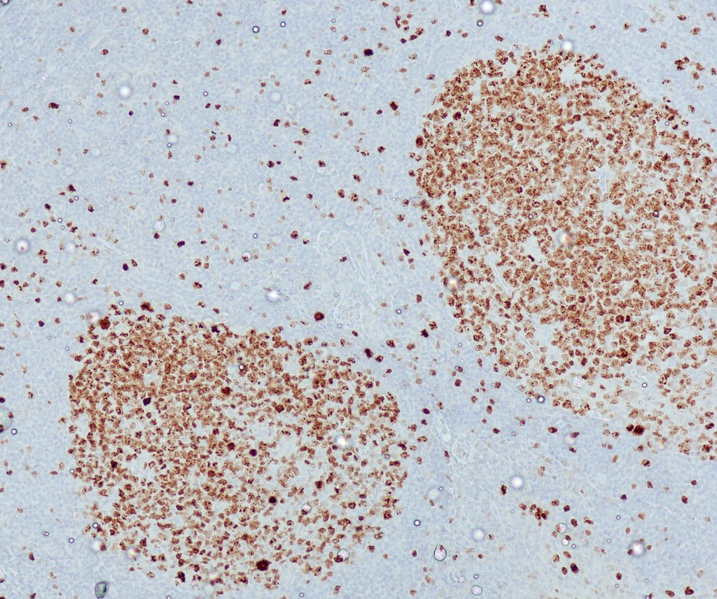 Ki-67 (QR015) Rb 0,5 ml konsentraatti