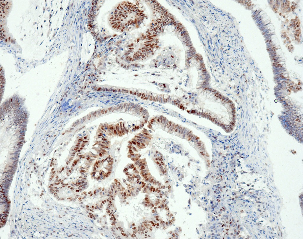 MSH6 (QR011) Rb 0,5 ml konsentraatti