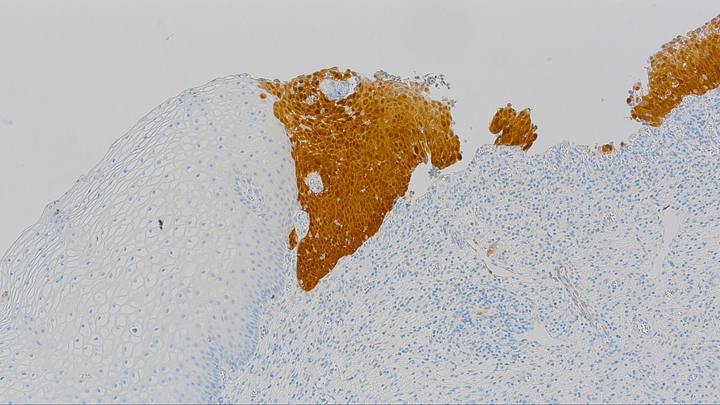 p16 (QR019) Rb 0,5 ml konsentraatti