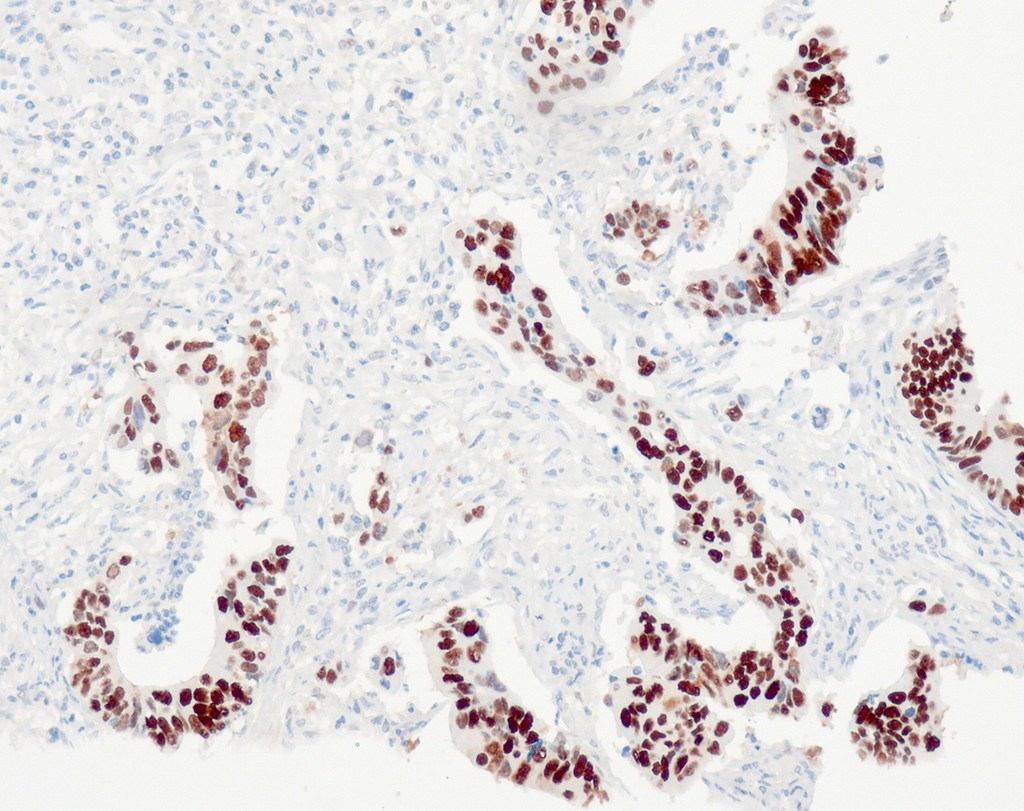 p53 (QR025) Rb 0,5 ml konsentraatti