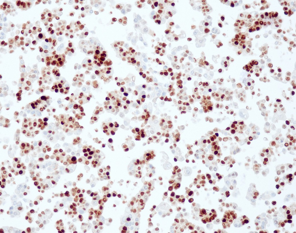 Progesterone Receptor (QR014) Rb 0,5 ml konsentraatti